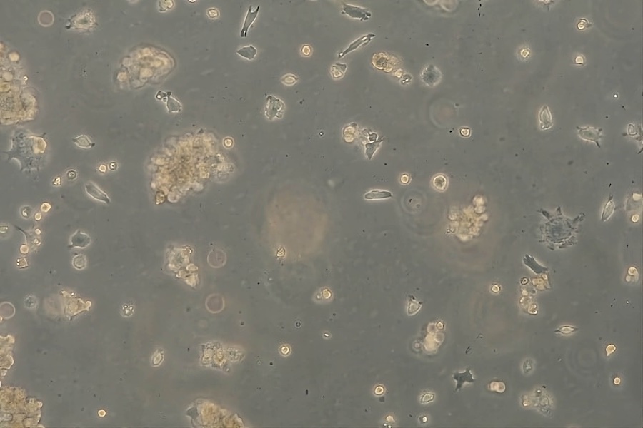 Cytopathic effects on host cells by viruses (100 x). © 2025 DITF